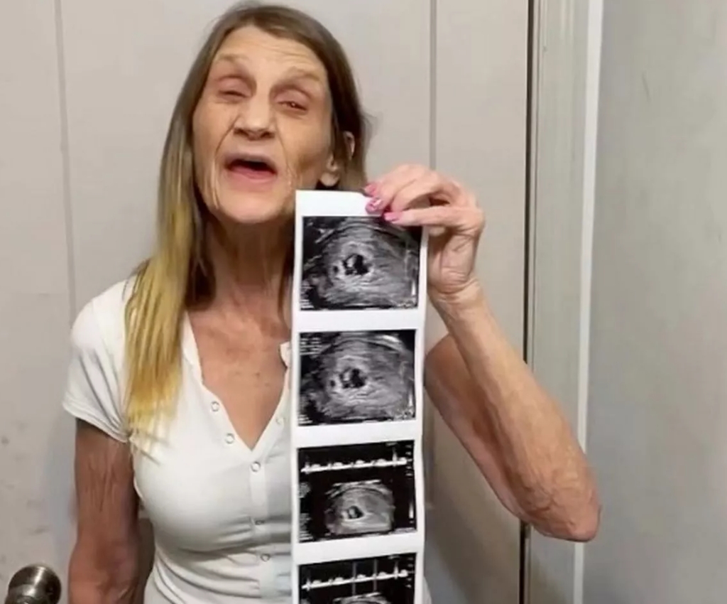 63-летняя женщина, вышедшая замуж за 26-летнего парня, готовится стать мамой